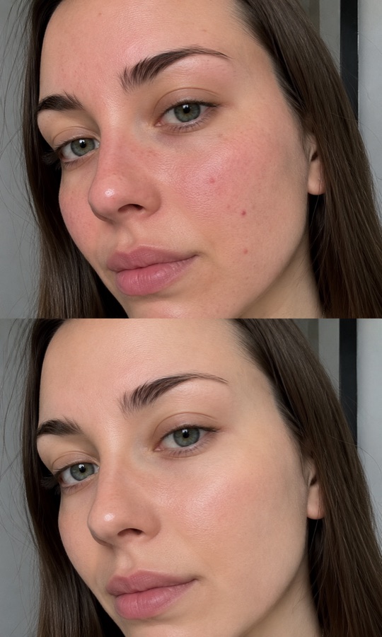 Skin transformation before and after